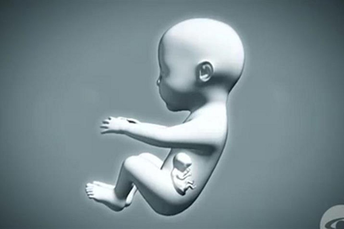 Νεογέννητο είχε στην κοιλιά του το… δίδυμο αδελφάκι του