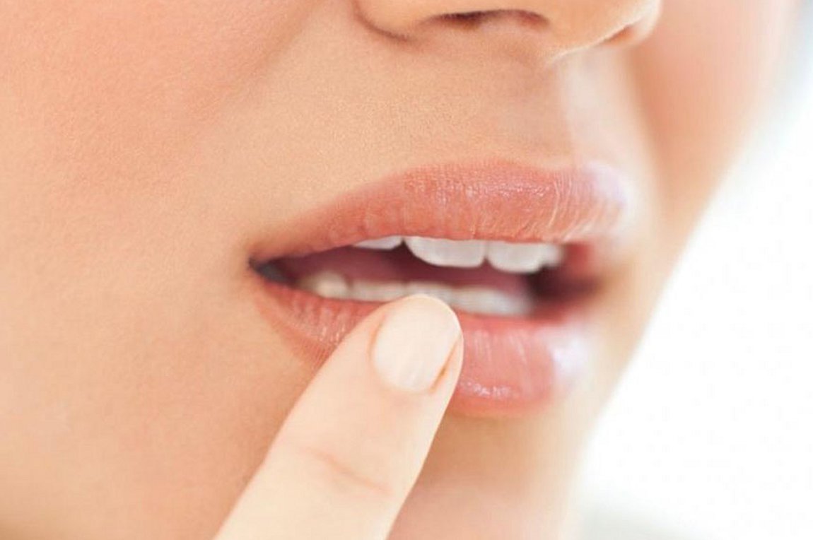 Επιχείλιος έρπης: Αίτια, συμπτώματα, αντιμετώπιση και πρόληψη