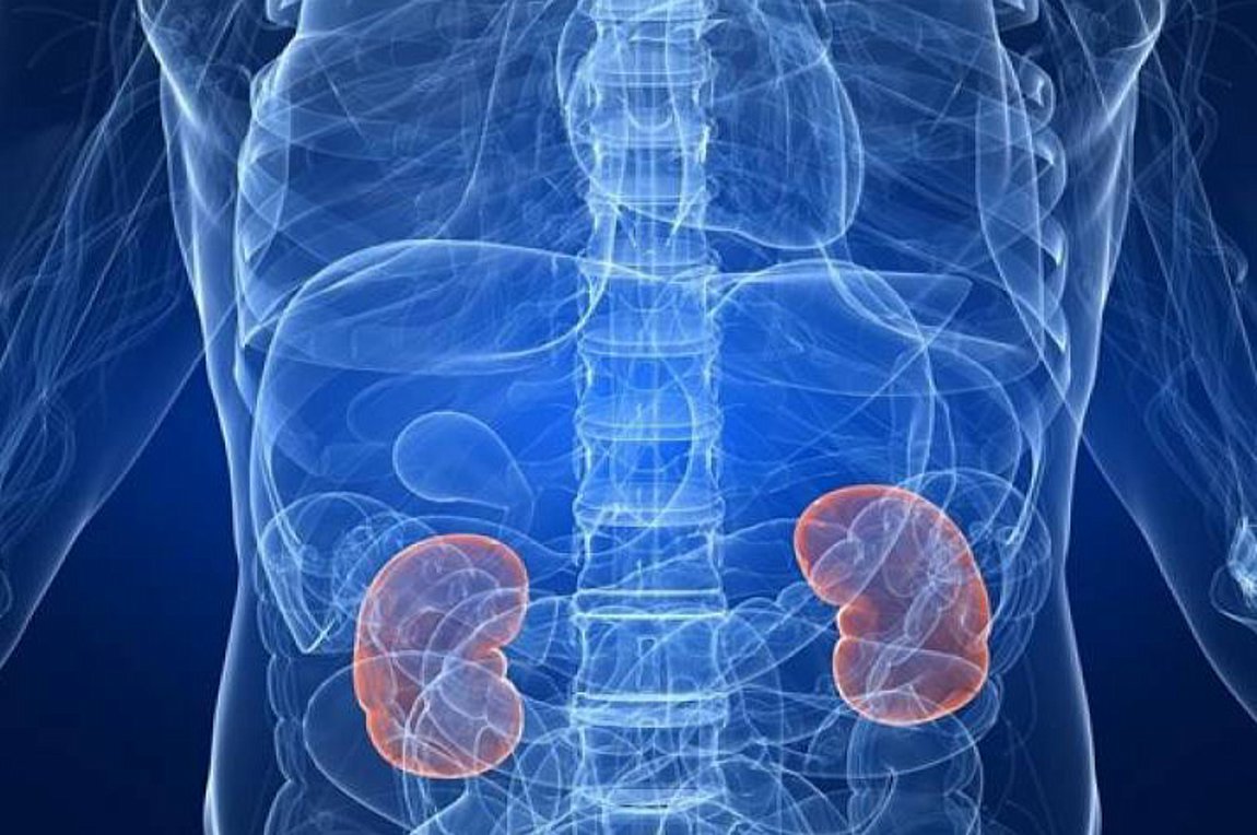 Πέτρες στους νεφρούς – Διατροφή: Αυτές οι τροφές σας προστατεύουν