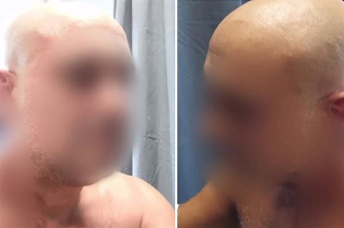 Σοκ στην Καλαμάτα: Γυναίκα κάρφωσε κουζινομάχαιρο στον λαιμό του κουμπάρου της