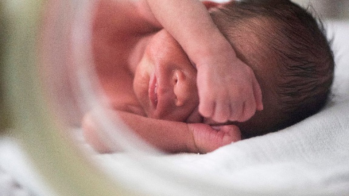 Γεννήθηκε μωρό με ουρά 12 εκατοστών στη Βραζιλία – Πολύ σπάνια περίπτωση