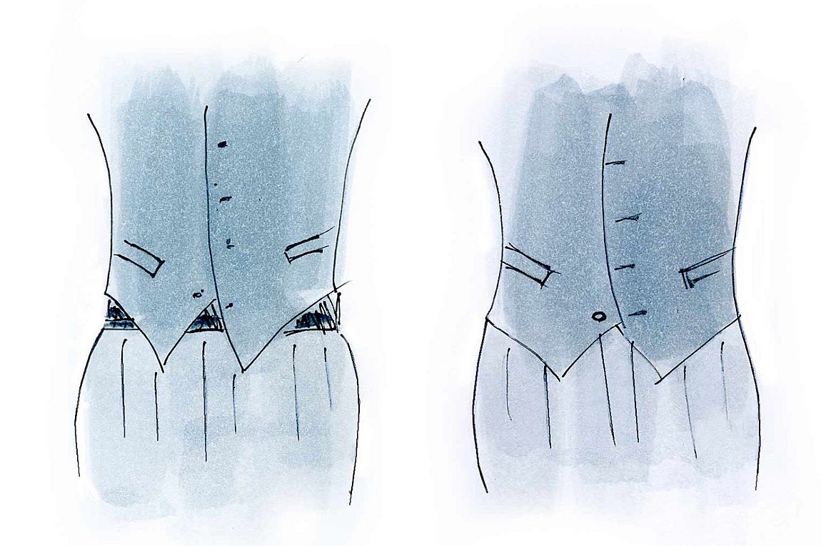 Tο γελεκάκι που φορείς