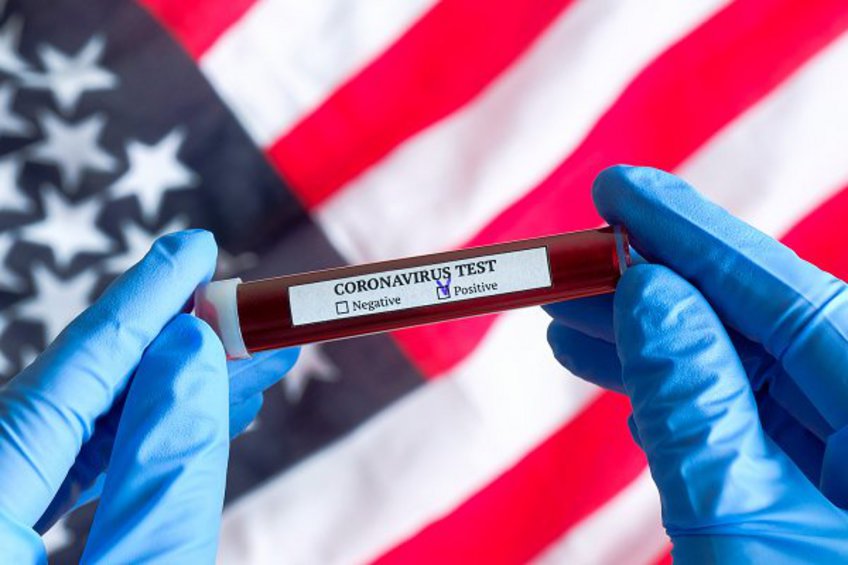 ΗΠΑ: Οι υγειονομικές αρχές καλούν τους Αμερικανούς να ετοιμαστούν για την εξάπλωση του κορωνοϊού στη χώρα