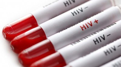 ΕΟΔΥ: 550 νέα περιστατικά HIV λοίμωξης - Αυξημένο το ποσοστό με ακαθόριστο τρόπο μόλυνσης