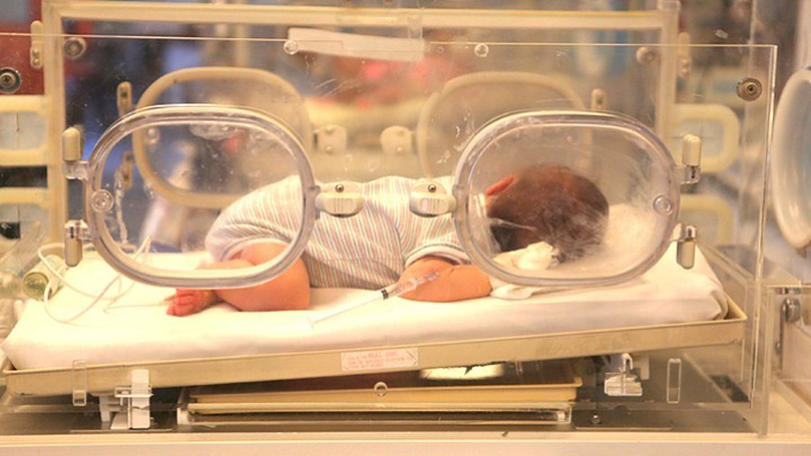 Με υποστηρικτική θεραπεία αντιμετωπίζονται τα νεογνά με κορωνοϊό