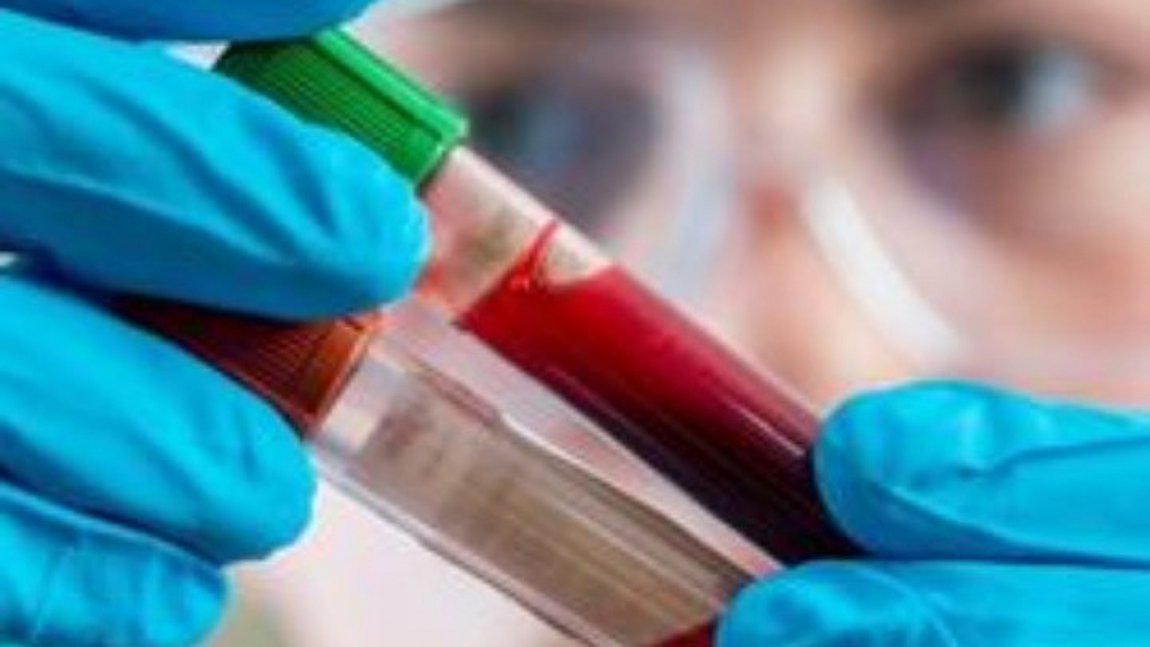 Περού: Βρέφος ήρθε στον κόσμο μολυσμένο από τον κορωνοϊό