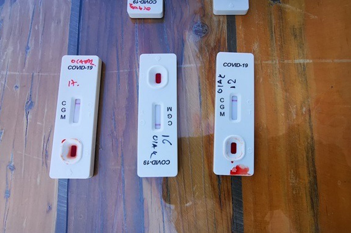 Κλιμάκια του ΕΟΔΥ έκαναν τεστ σε Γουμένισσα και νότια Ρόδο