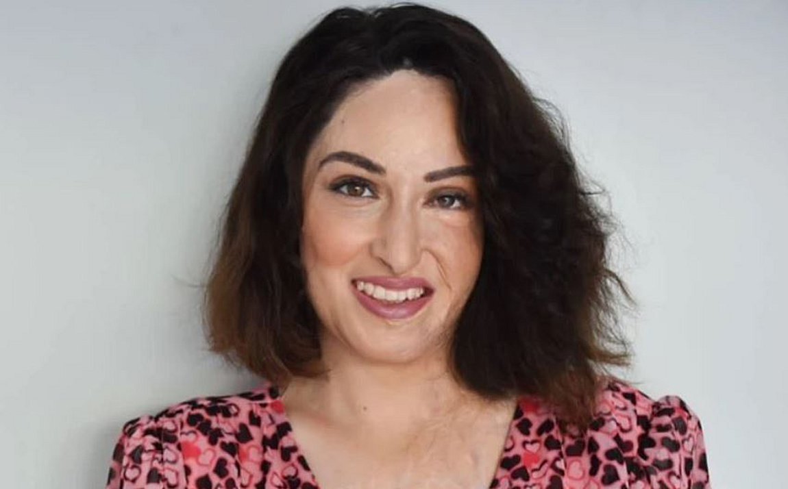 Ιωάννα Παλιοσπύρου: Χαμογελάει ξανά και δείχνει τη νέα της εικόνα