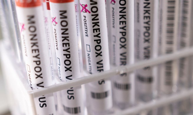 CDC : Les cas confirmés de monkeypox figurent parmi les 1 000 dans 29 pays |  modules, santé