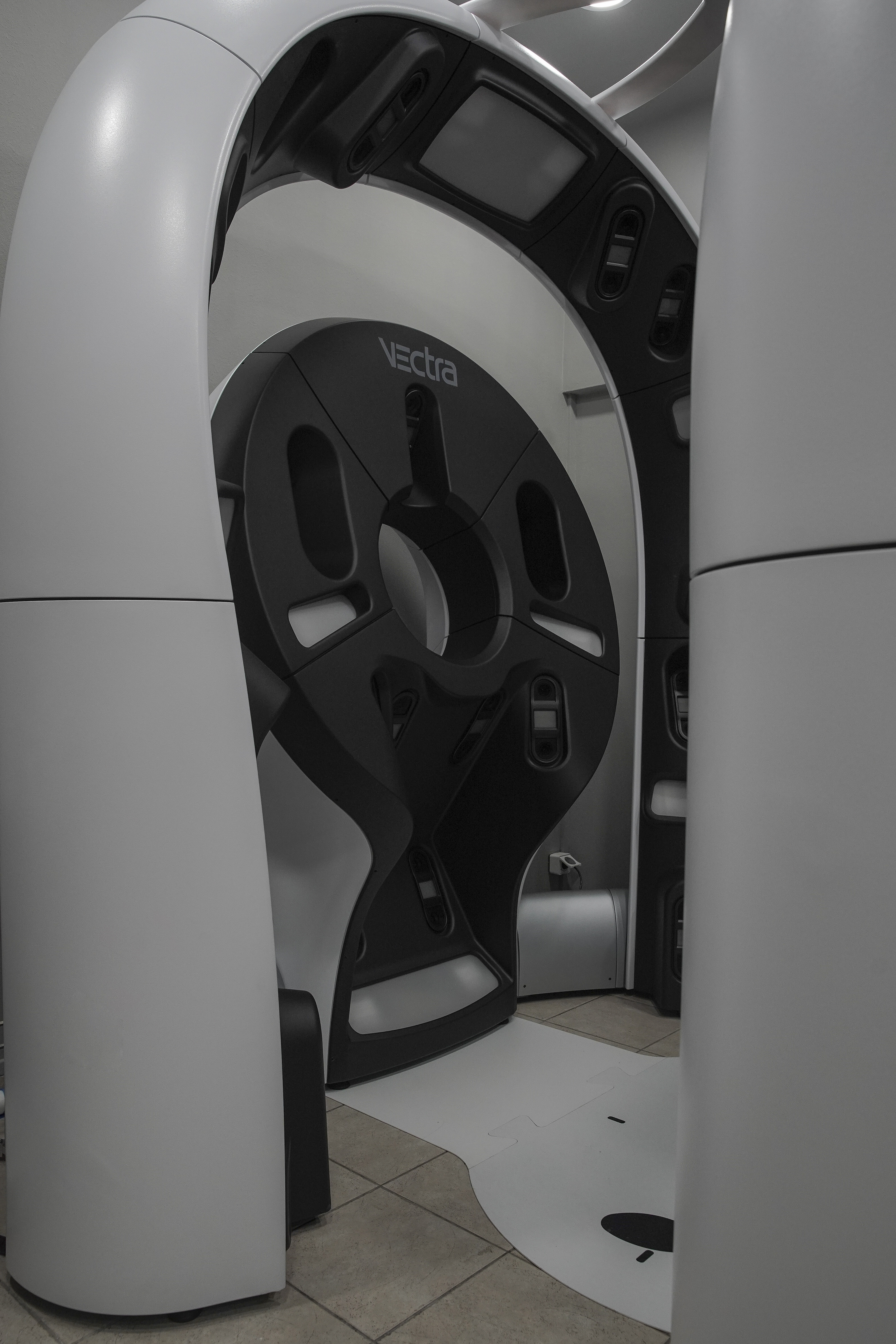 Το νέο υπερσύγχρονο μηχάνημα VECTRA WB360, αποκλειστική δωρεά του Ιδρύματος Ωνάση προς το νοσοκομείο 'Ανδρέας Συγγρός'