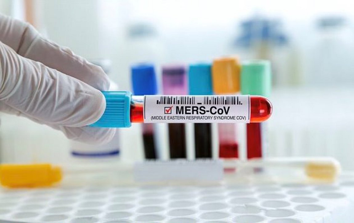 Τι είναι ο «ιός της καμήλας» που έρχεται από το Μουντιάλ – Παγώνη: Σκοτώνει 1 στους 3 που θα νοσήσουν