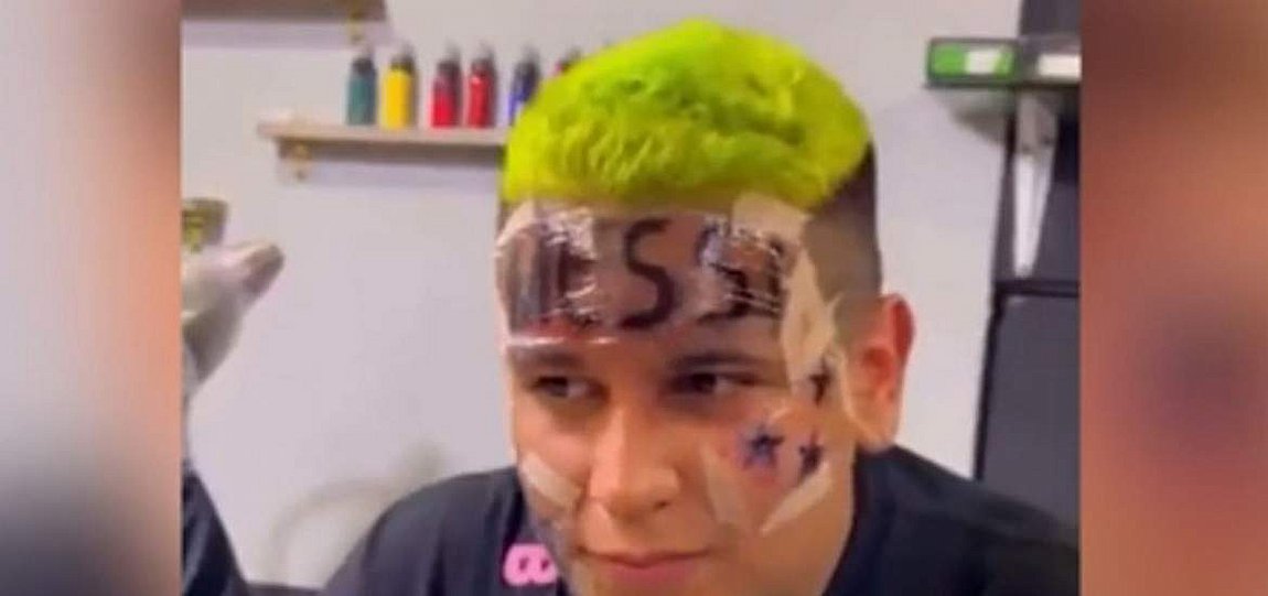 ΒΙΝΤΕΟ: Οπαδός έκανε τατουάζ στο μέτωπo του το όνομα του Μέσι