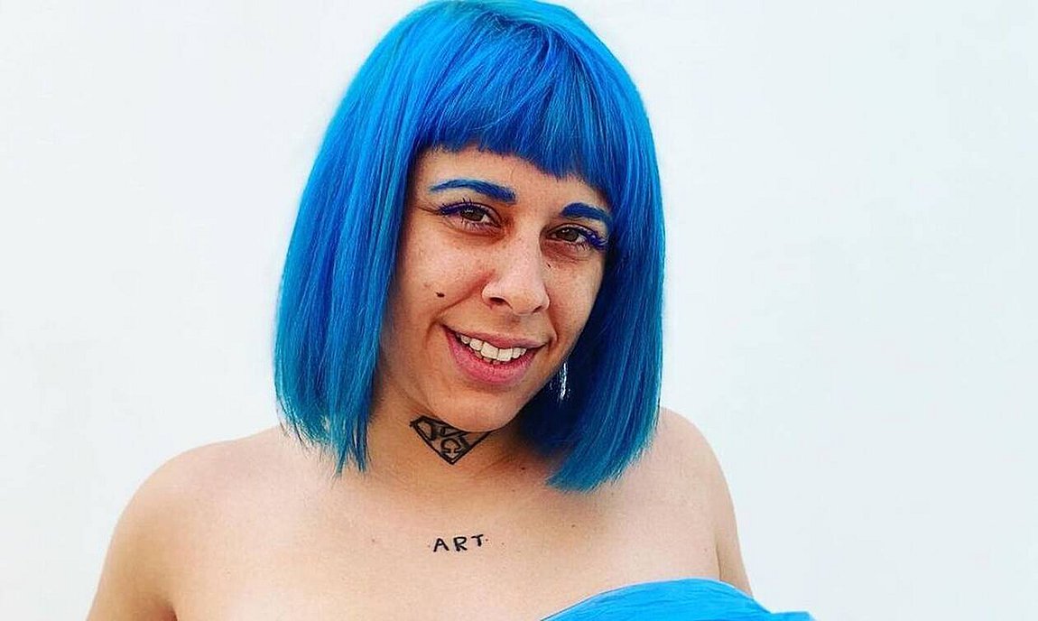 Super Κική: Δημοσίευσε φωτογραφίες σοκ της κακοποιημένης φίλης της