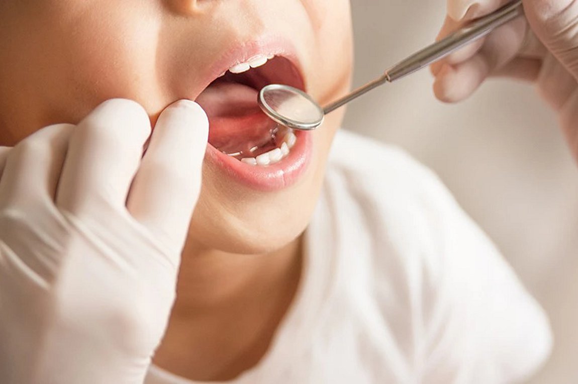 Dentist Pass: Περισσότερες από 129.000 αιτήσεις