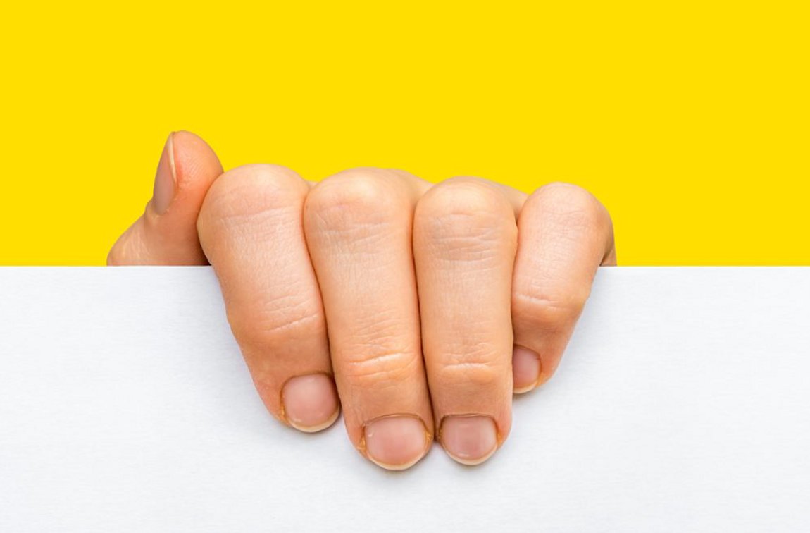 13 λόγοι για τους οποίους πρήζονται τα δάχτυλα σας-Πότε να ανησυχήσετε