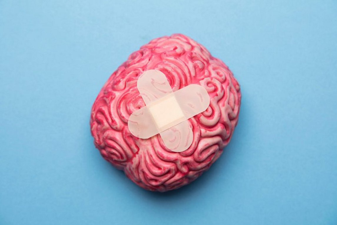 Εγκεφαλικά: Πώς θα μειώσει η Ελλάδα τα υψηλά ποσοστά θνητότητας