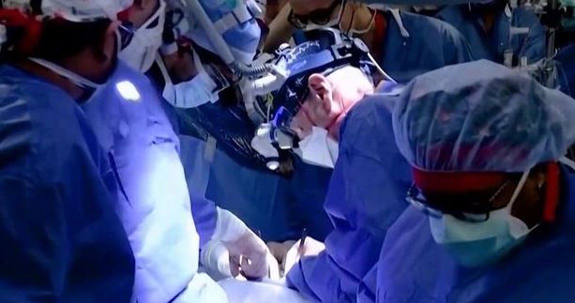 Μεταμόσχευση ήπατος από ζώντα δότη για πρώτη φορά στην Ελλάδα