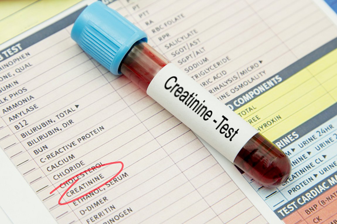 Υψηλή κρεατινίνη: Τα συμπτώματα που δεν πρέπει να αγνοήσετε
