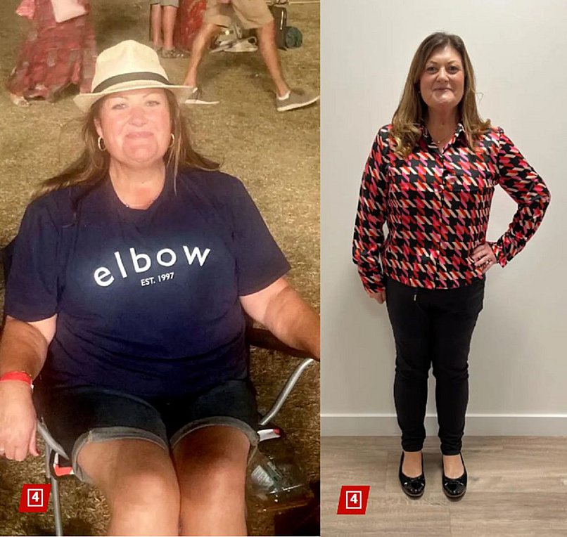 Έχασε 63 κιλά αφαιρώντας ένα πράγμα από τη διατροφή της