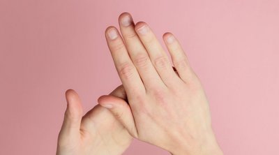 Τα ασυνήθιστα σημάδια στα χέρια που μπορεί να δείχνουν πρόβλημα στην καρδιά ή τους πνεύμονες

