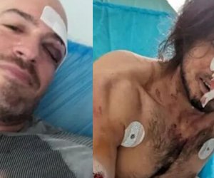 «Μας χτυπούσαν και μας μαχαίρωναν δίχως έλεος»: Συγκλονιστικές μαρτυρίες για την επίθεση στους εθελοντές της Πάρνηθας - Φωτογραφίες σοκ