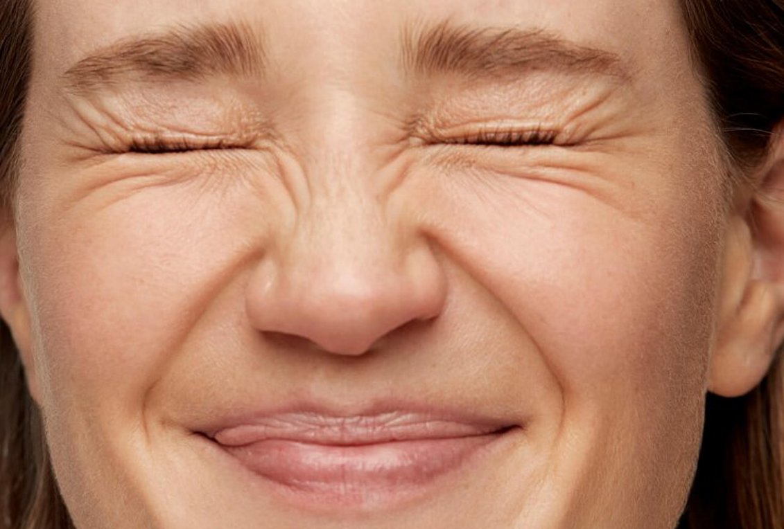 Καφέ κηλίδες και πανάδες: Πώς θα αντιμετωπίσουμε τα ηλιακά σημάδια στο πρόσωπο;