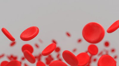 Χαμηλά αιμοπετάλια: 3 συμπτώματα που μπορεί να δείχνουν πρόβλημα στο αίμα

