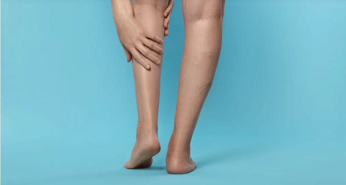 Λεμφοίδημα: Τι είναι και πώς αντιμετωπίζεται