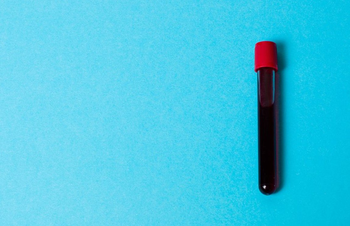 Πότε η γενική αίματος μπορεί να δείξει καρκίνο